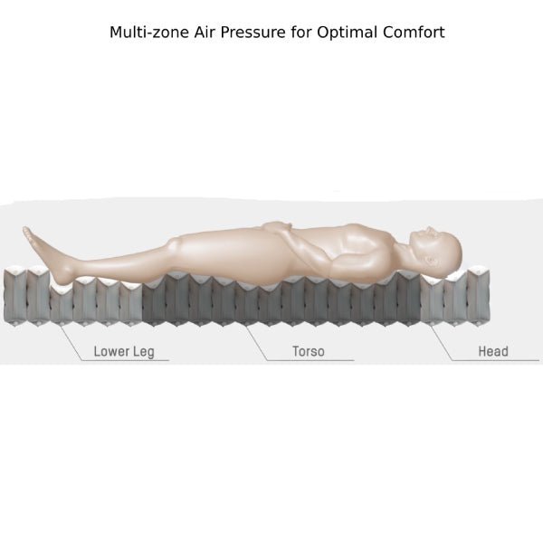 Low Air Loss and Alternating Pressure Relief Optima Mattress System for Bed Sore Prevention & Treatment - Wound Care Mattress