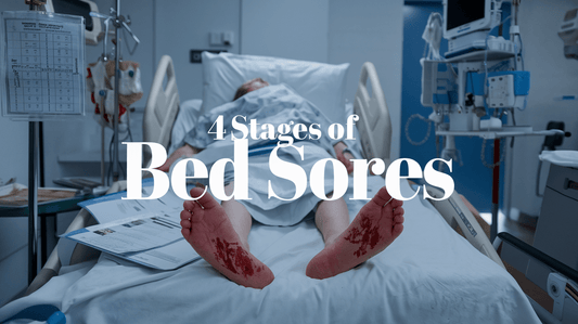 What are the Four Stages of Bed Sores? - Wound Care Mattress