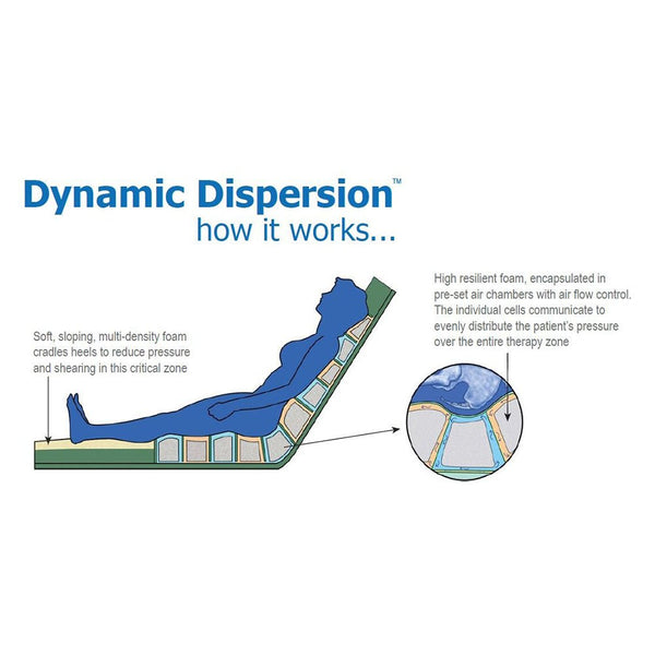 Foam Pressure Relief Mattress Dynamic Dispersion Air Mattress Wound